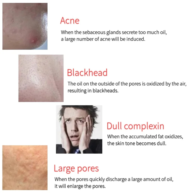Cat Paw Face Oil Absorbing Roller Volcanic Stone Blemish Remover Facial Shiny Changing Pores Oil Removal Massage Artifact Tools