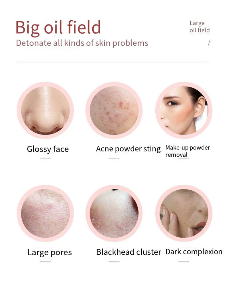 Cat Paw Face Oil Absorbing Roller  Volcanic Stone Blemish Remover Facial Shiny Changing Pores Oil Removal Massage Artifact Tools